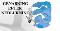 GENÅBNING EFTER NEDLUKNING