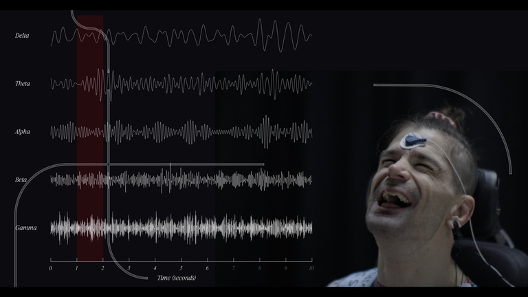 This is what it sounds like when I think / Xenon Residency